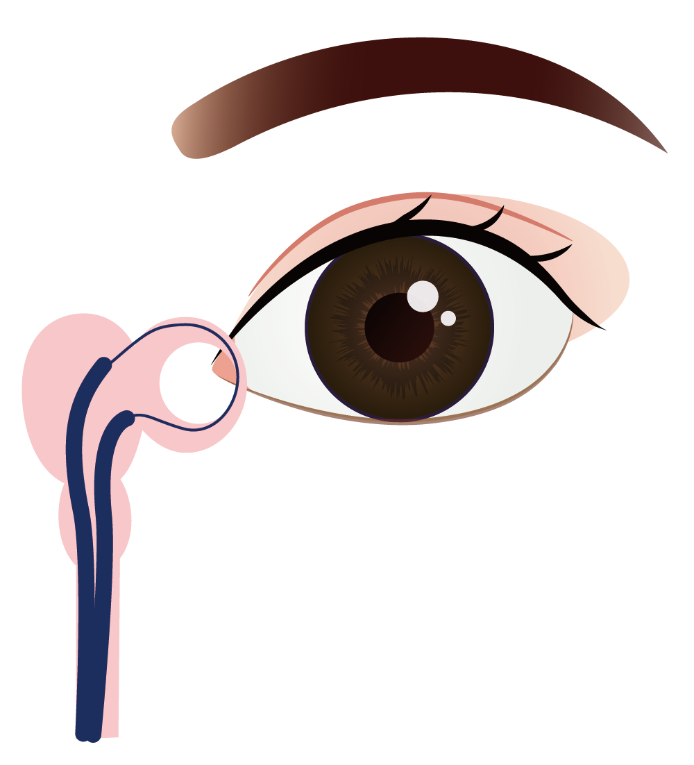 涙道内視鏡手術